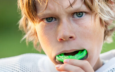 Mouthguards